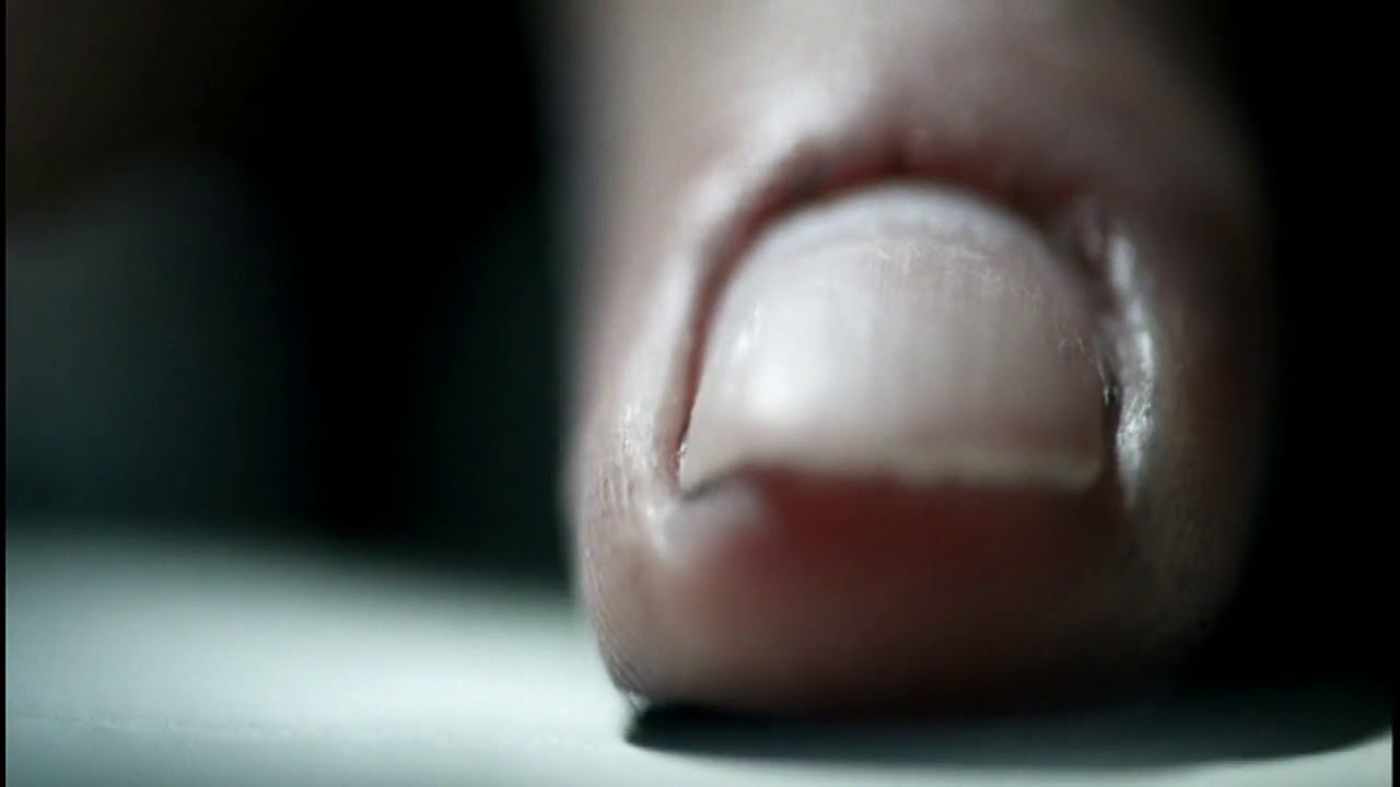 Fingerprint